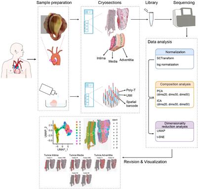 Visualization and Analysis of Gene Expression in Stanford Type A Aortic Dissection Tissue Section by Spatial Transcriptomics